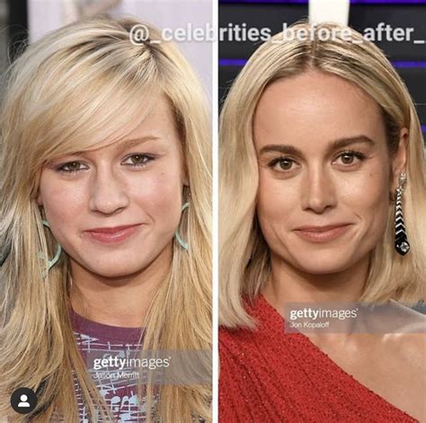 Brie Larson Plastic Surgery: Nose job, Boob Job,。